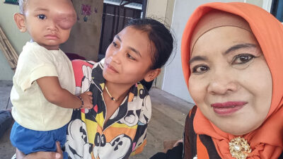 Srikandi Pemuda Pancasila Bantu Operasi Tumor Bocah Kurang Mampu Riski Alfarizi