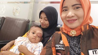 Srikandi Pemuda Pancasila Bawa Berobat Bocah Tumor Mata ke RSCM Jakarta