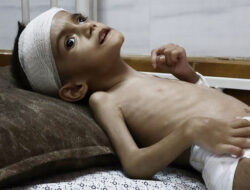 Malanutrisi dan Kelangkaan Bahan Bakar Ancam Nyawa Bayi-Bayi Prematur di Gaza