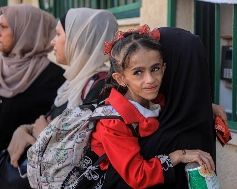 Tak Dapat Izin dari Israel, Para Ibu di Gaza Tak Bisa Dampingi Anak Mereka ke Luar Negeri untuk Berobat