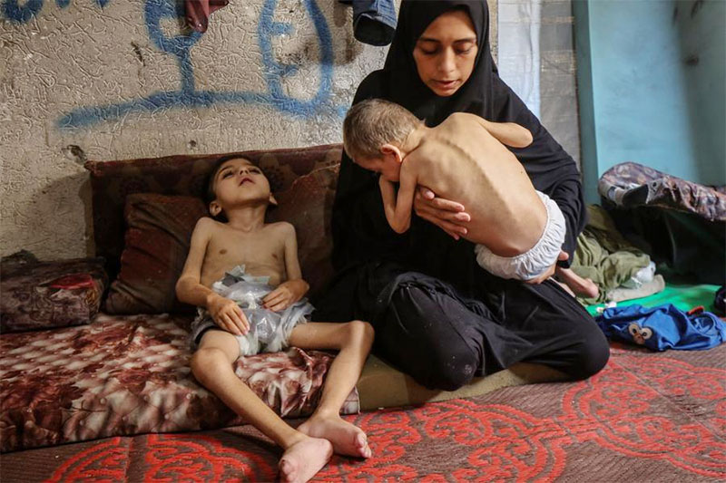 WHO: Gizi Buruk di Gaza Capai Tingkat yang Mengkhawatirkan
